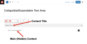 How To Add A Collapsible/Expandable Text Area In WordPress